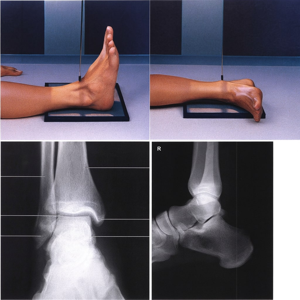 Ankle Joint (Pergelangan Kaki)