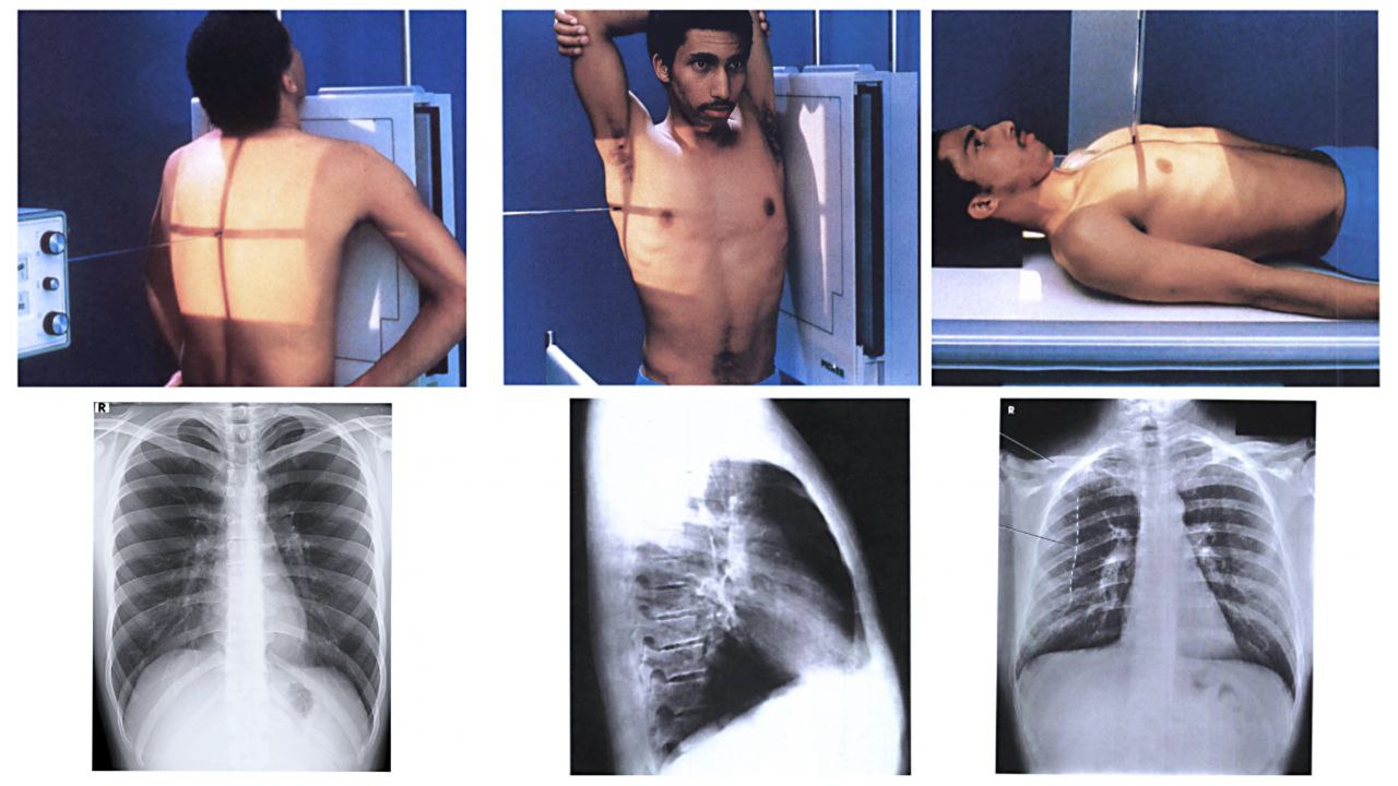 Thorax (Dada)
